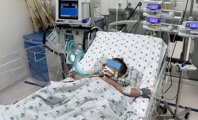 Một bệnh nhi tay chân miệng độ 3 điều trị tại Bệnh viện Nhi Đồng Thành phố. Ảnh: Bệnh viện cung cấp