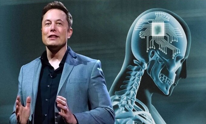 Musk bày tỏ tin tưởng vào độ an toàn của chip não do Neuralink phát triển. Ảnh: Punch