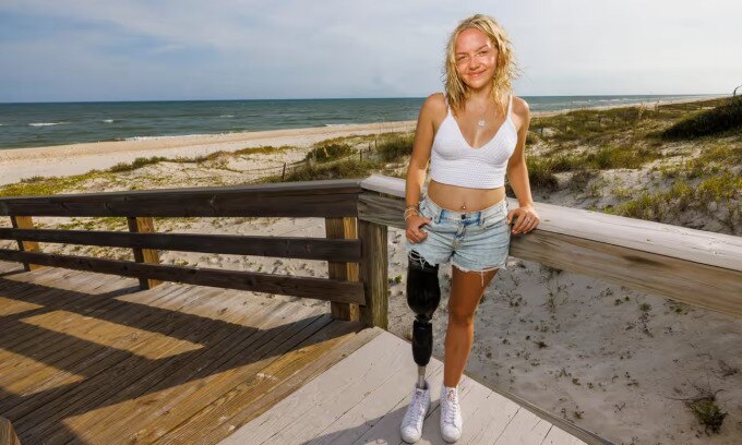 Addison Bethea, 18 tuổi, đứng tại bờ biển St George, bang Florida, một năm sau vụ tấn công. Ảnh: Guardian