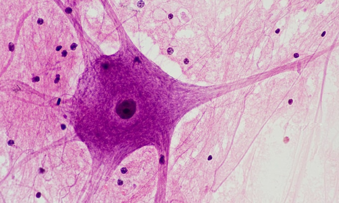 Tế bào thần kinh được quan sát dưới kính hiển vi. Ảnh: Ed Reschke/Getty
