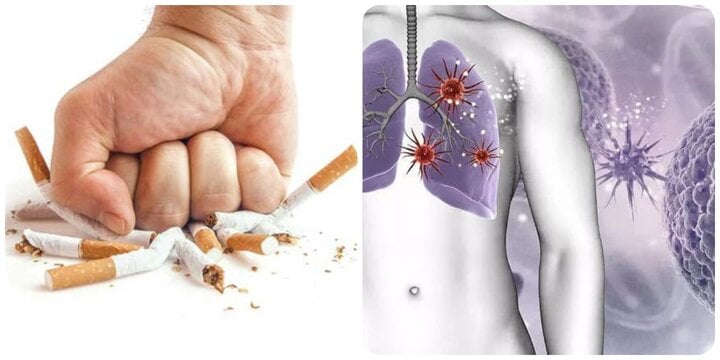 Cơ thể nhận được nhiều tác dụng tích cực sau khi bạn bỏ thuốc lá.