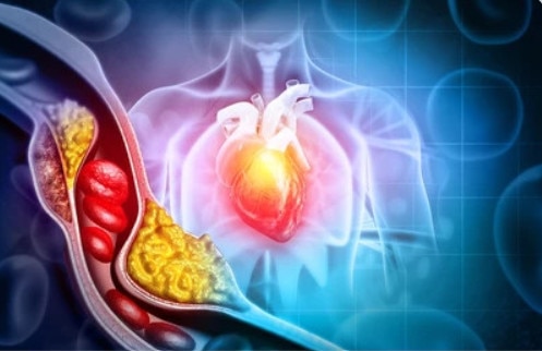 Cách ăn được Đại học Harvard chứng minh là giảm cholesterol, bệnh tim, đột quỵ - Ảnh 1.