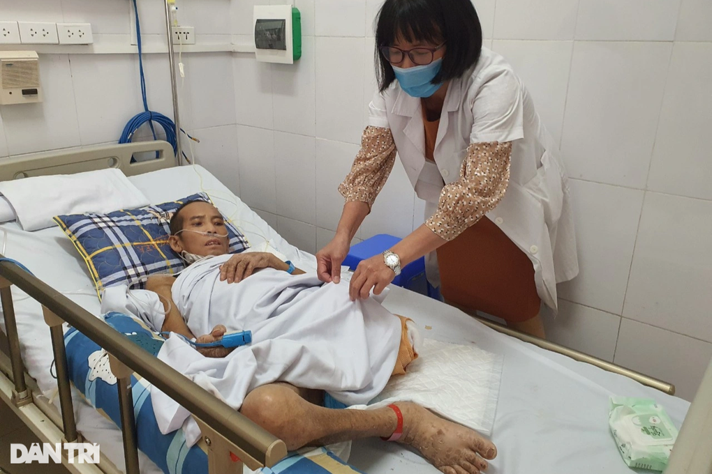 Nhiễm vi khuẩn đặc biệt, người bố 3 con phải cắt bỏ chân 6 lần - 2 Nhiễm vi khuẩn đặc biệt, người bố 3 con phải cắt bỏ chân 6 lần - 2