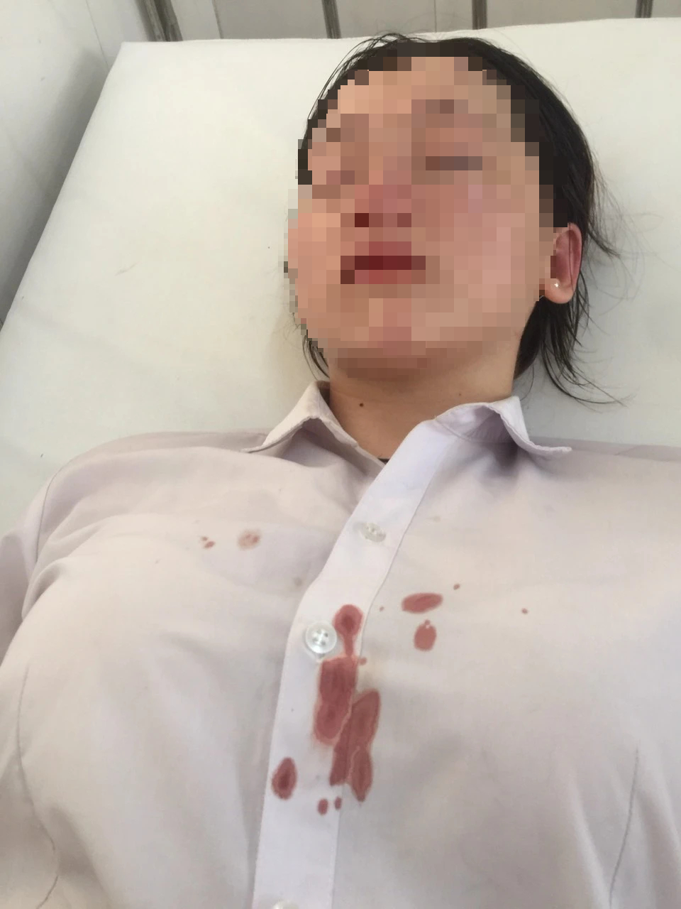 Nữ sinh lớp 11 bị đánh hội đồng tổn thương sọ, gãy sống mũi- Ảnh 4. Nữ sinh lớp 11 bị đánh hội đồng tổn thương sọ, gãy sống mũi- Ảnh 4.