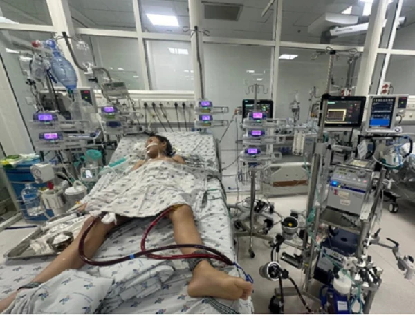 Bé gái viêm cơ tim nguy kịch sau 2 ngày sốt nhẹ, vã mồ hôi- Ảnh 1. Bé gái viêm cơ tim nguy kịch sau 2 ngày sốt nhẹ, vã mồ hôi- Ảnh 1.