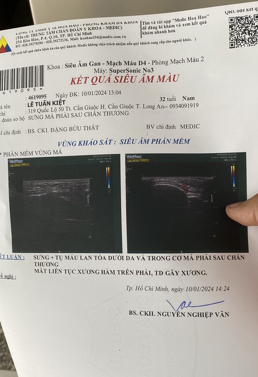 Bị đấm gục trên sân, trọng tài VFF lên tiếng tố cáo - 3 Bị đấm gục trên sân, trọng tài VFF lên tiếng tố cáo - 3