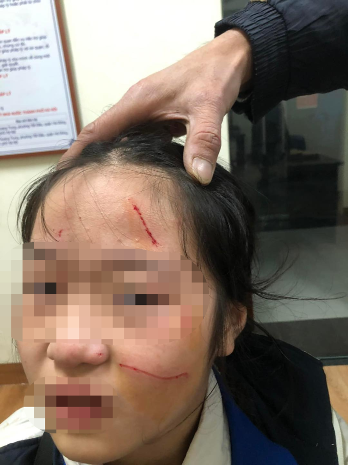 Tình trạng của con chị Vân khi được đưa đến công an phường Kiến Hưng, quận Hà Đông. Ảnh: Phụ huynh cung cấp