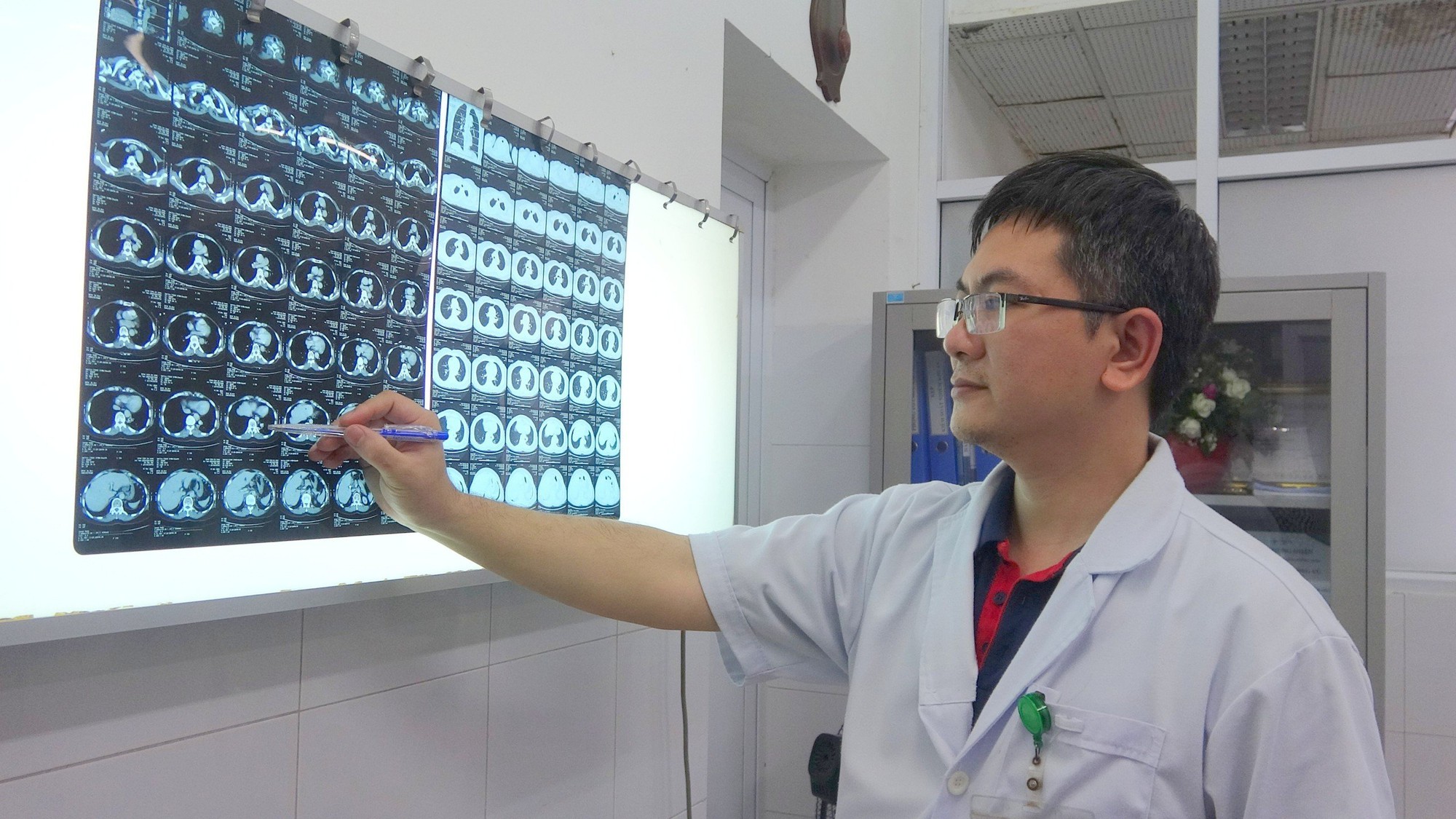 Đà Nẵng: Phẫu thuật nội soi cắt bỏ phổi biệt lập có mạch nuôi lớn hiếm gặp- Ảnh 2. Đà Nẵng: Phẫu thuật nội soi cắt bỏ phổi biệt lập có mạch nuôi lớn hiếm gặp- Ảnh 2.