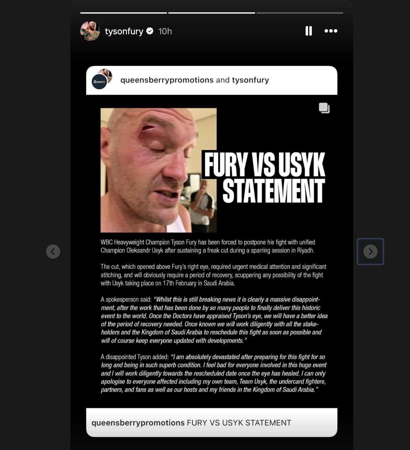 Vì sao trận đại chiến quyền anh hạng nặng giữa Tyson Fury và Oleksandr Usyk bị hoãn?- Ảnh 2.
