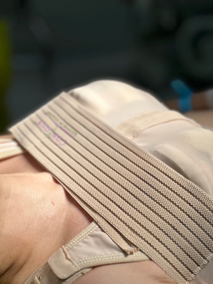Kỹ thuật tạo khoang đúng với kích cỡ túi ngực trong nâng ngực - 2