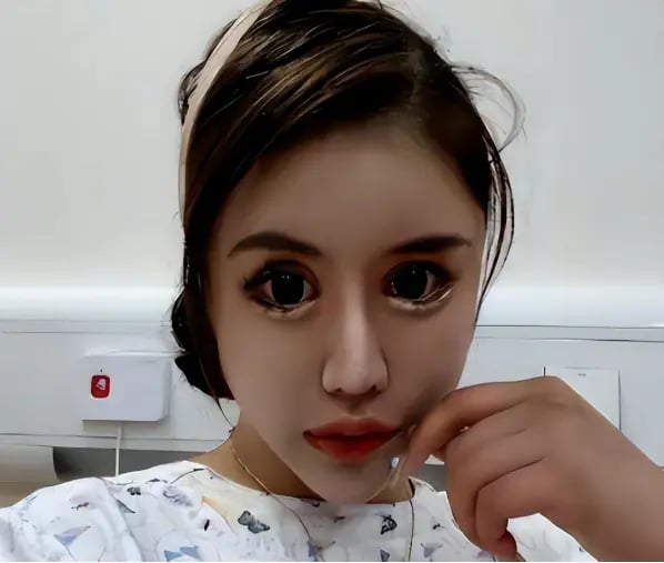 Cô gái nghiện làm đẹp từ năm 13 tuổi, chi 14 tỷ đồng để phẫu thuật thẩm mỹ, hiện tại hối hận nhưng đã muộn màng - Ảnh 5. Cô gái nghiện làm đẹp từ năm 13 tuổi, chi 14 tỷ đồng để phẫu thuật thẩm mỹ, hiện tại hối hận nhưng đã muộn màng - Ảnh 5.