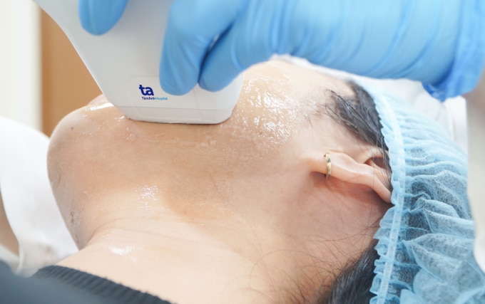 Nâng cơ mặt, trẻ hóa da bằng công nghệ SUPERB tại Bệnh viện Tâm Anh TP.HCM. Ảnh minh họa: Anh Thư