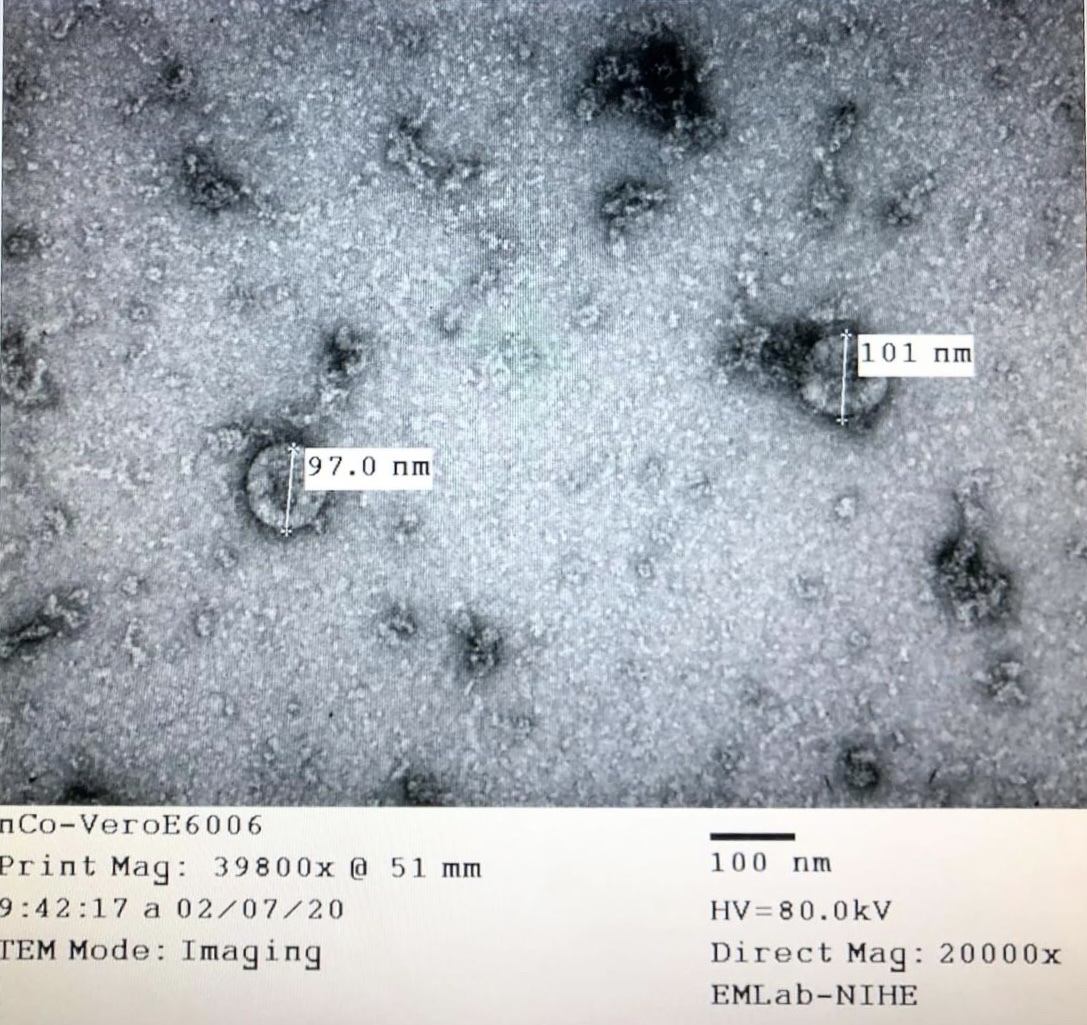 SARS-CoV-2 tiếp tục biến đổi, né miễn dịch- Ảnh 1. SARS-CoV-2 tiếp tục biến đổi, né miễn dịch- Ảnh 1.
