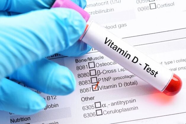 Cách ngăn ngừa tình trạng thiếu vitamin D ở trẻ em- Ảnh 2. Xét nghiệm định lượng Vitamin D3 (25OH vitamin D) có ý nghĩa gì?