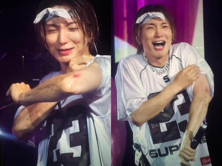Leeteuk bị thương ở tay khi đang biểu diễn - Ảnh: Internet Leeteuk bị thương ở tay khi đang biểu diễn vào hồi tháng 10-2023 - Ảnh: Internet