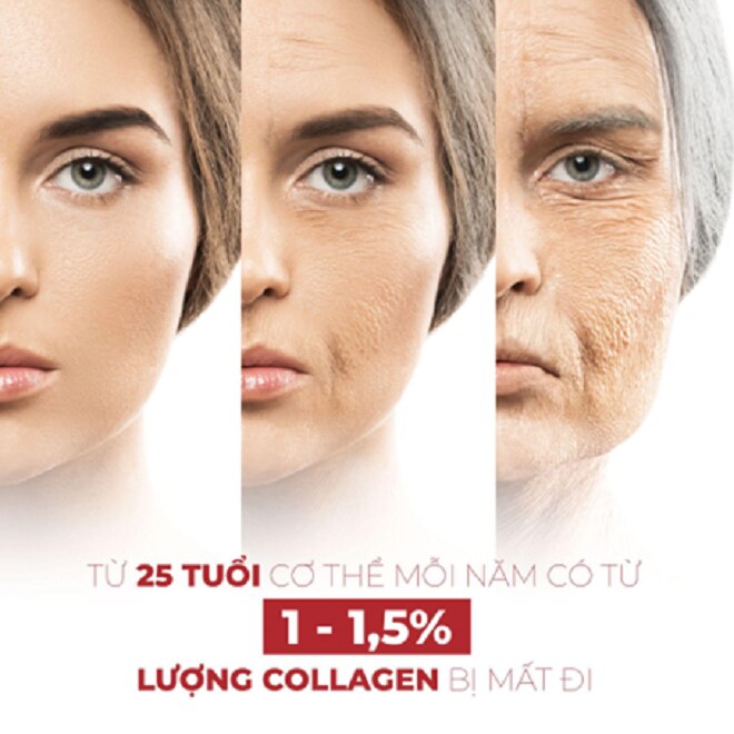Từ tuổi 25, mỗi năm, làn da mất đi từ 1 -1,5% lượng collagen.