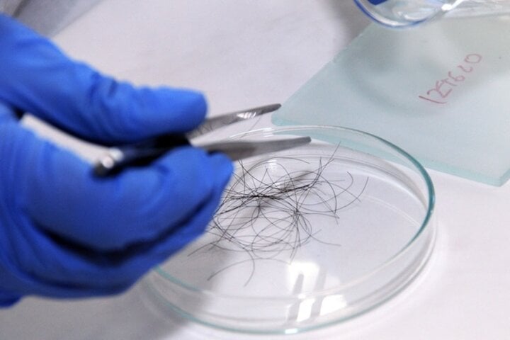 Nếu muốn xét nghiệm ADN chỉ cần có 10 sợi tóc có đủ chân, hoặc móng tay hay mẫu máu. (Ảnh minh hoạ)