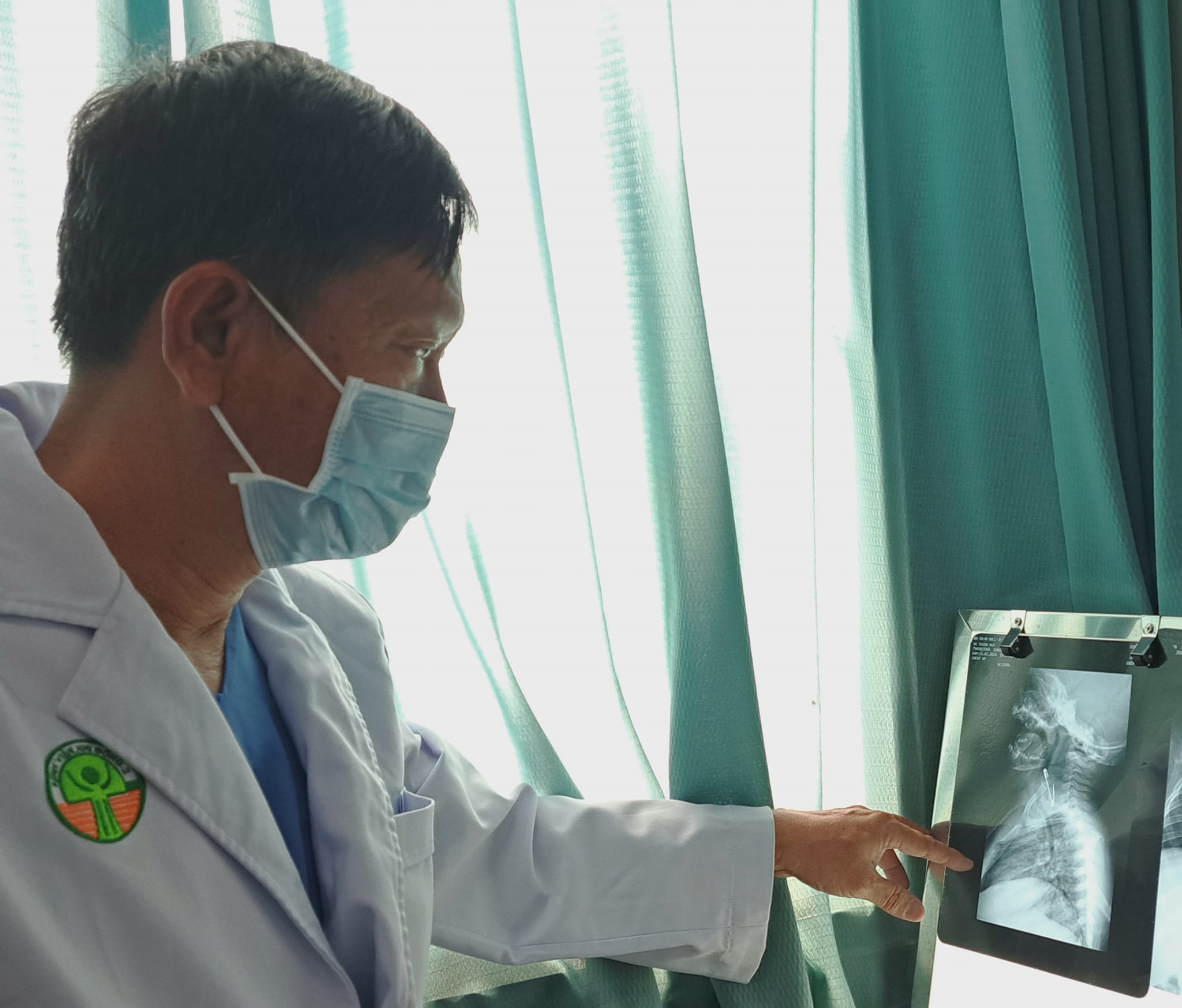 Chiếc kim tây nằm trong thực quản bé trai- Ảnh 1. Chiếc kim tây nằm trong thực quản bé trai- Ảnh 1.