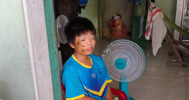 Điều tra vụ nam sinh lớp 6 nghi bị bạn đánh trên đường đi học về nhà- Ảnh 1. Em B. được cho là bị em P. đạp ngã xe máy trên đường đi học về - Ảnh: A.X.