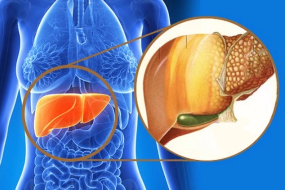 4 dấu hiệu cảnh báo gan của bạn không tốt, 3 nhóm người này cần giải độc gan để phòng bệnh - Ảnh 4. 4 dấu hiệu cảnh báo gan của bạn không tốt, 3 nhóm người này cần giải độc gan để phòng bệnh - Ảnh 4.