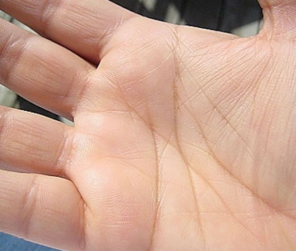 Lòng bàn tay cũng dự báo được tuổi thọ một người? Bác sĩ nói thẳng: Người sống trường thọ thường có 3 đặc điểm này - Ảnh 3. Lòng bàn tay cũng dự báo được tuổi thọ một người? Bác sĩ nói thẳng: Người sống trường thọ thường có 3 đặc điểm này - Ảnh 3.