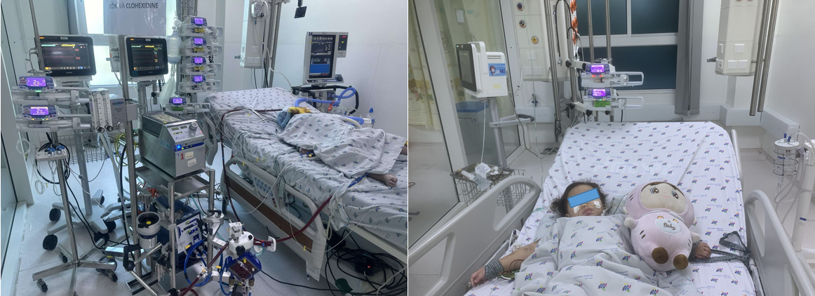 TP.HCM: Can thiệp ECMO cứu trẻ mắc cúm A gây tổn thương phổi- Ảnh 1. TP.HCM: Can thiệp ECMO cứu trẻ mắc cúm A gây tổn thương phổi- Ảnh 1.
