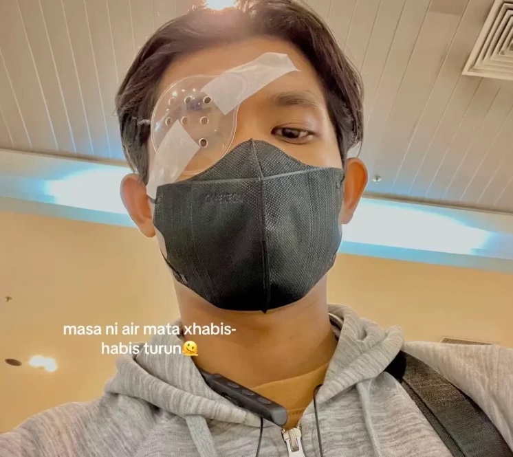Chàng trai Malaysia phải ghép giác mạc vì thói quen dụi mắt quá nhiều - Ảnh 1. Chàng trai Malaysia phải ghép giác mạc vì thói quen dụi mắt quá nhiều - Ảnh 1.