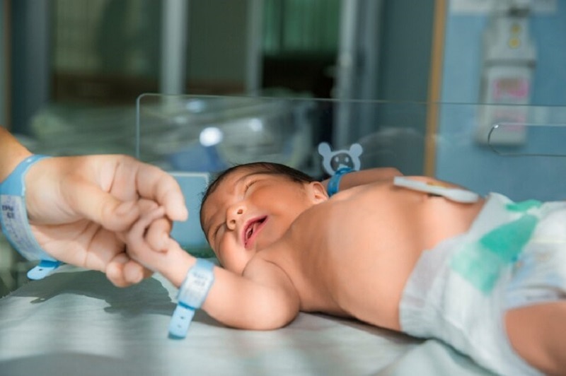 La ictericia neonatal pura leve suele aparecer 24 horas después del nacimiento y desaparece por sí sola.