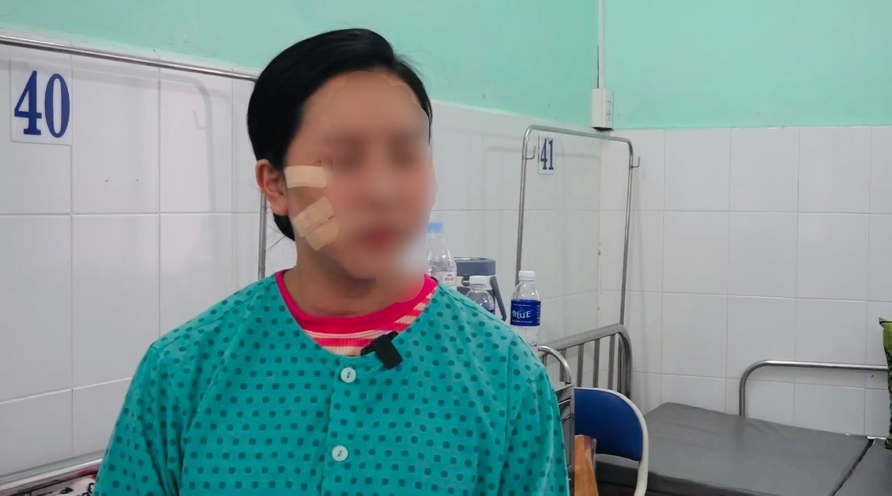Rước họa do căng chỉ để trẻ hóa da mặt- Ảnh 1. Rước họa do căng chỉ để trẻ hóa da mặt- Ảnh 1.