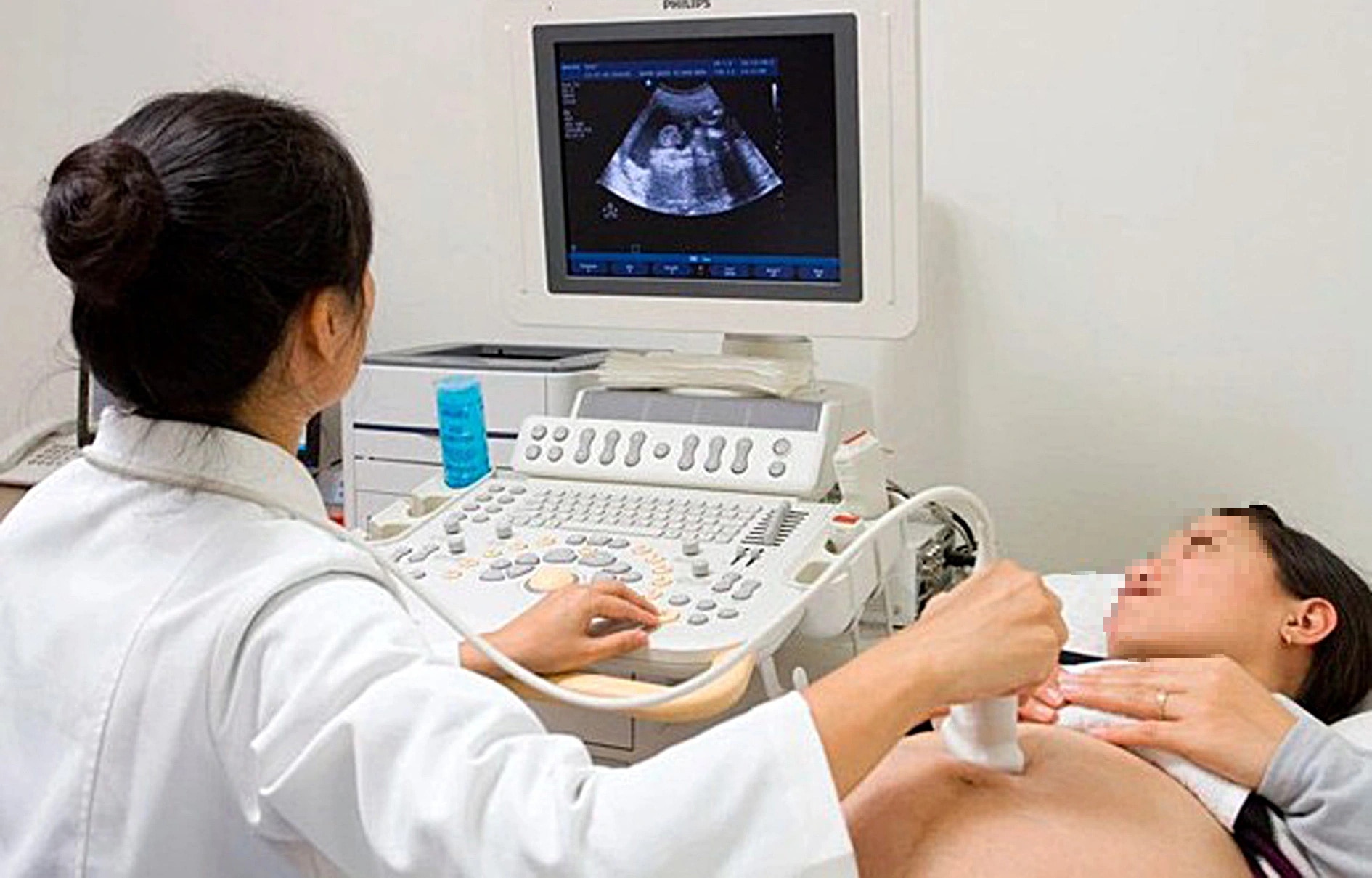 Sản phụ khám thai định kỳ - Ảnh: BVCC