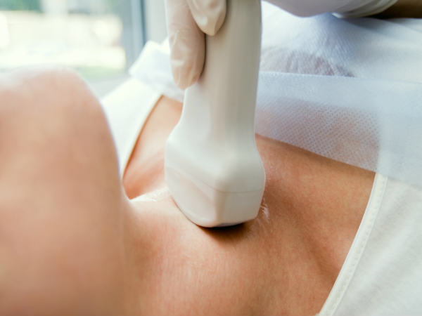 5 điều nhất định phải biết khi bị bướu cổ- Ảnh 2. 5 điều nhất định phải biết khi bị bướu cổ- Ảnh 2.