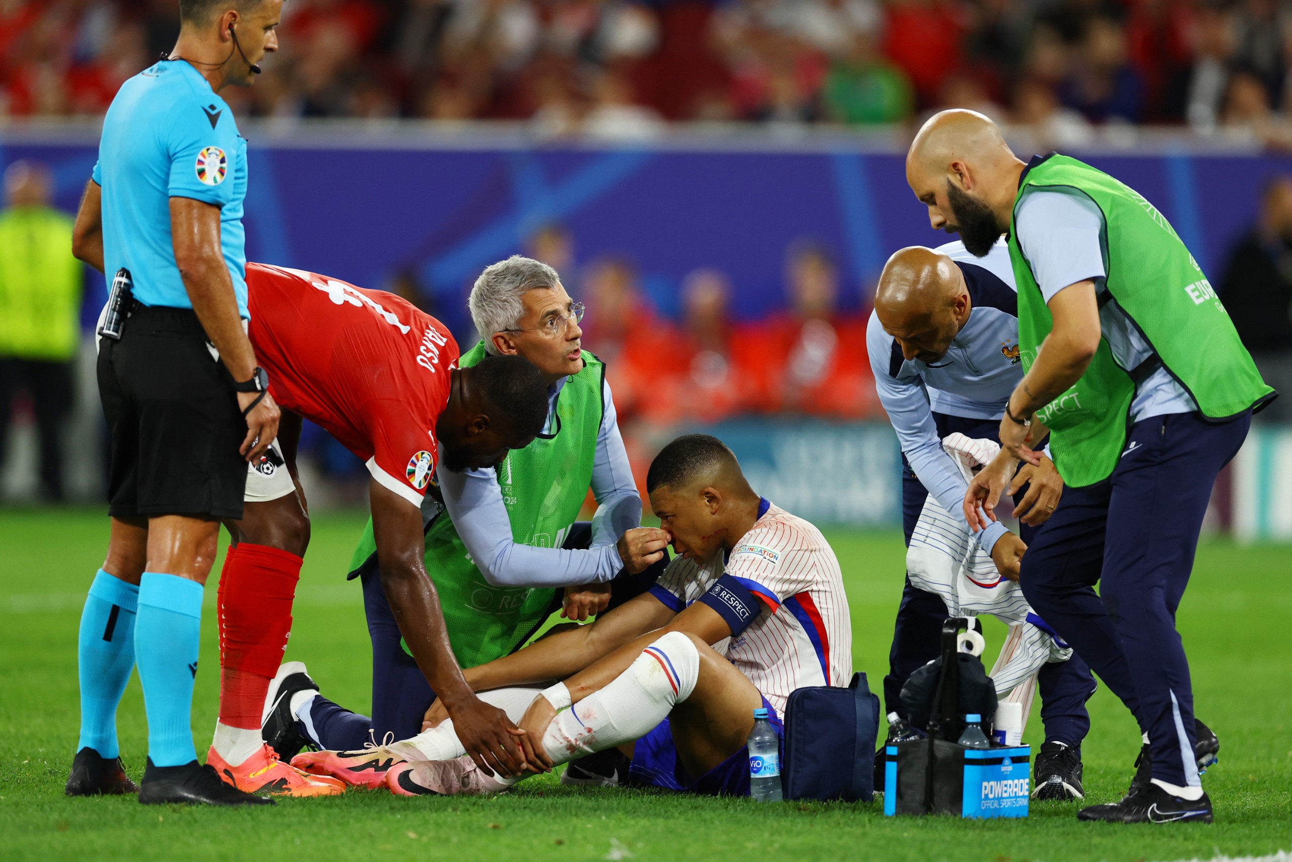 Vấn đề của Pháp không chỉ là cái mũi của Mbappe- Ảnh 2. Vấn đề của Pháp không chỉ là cái mũi của Mbappe- Ảnh 2.