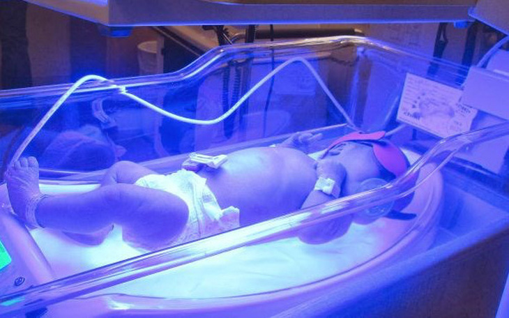 Máy tạo tiếng ồn trắng cho trẻ sơ sinh có thể nguy hiểm vì quá ồn- Ảnh 3. Trẻ sơ sinh vàng da, có đáng lo không?