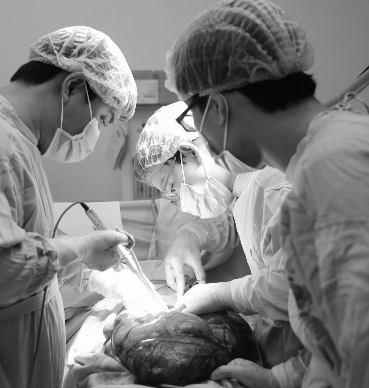 Hy hữu: Nam thanh niên 23 tuổi vác khối u khủng nặng đến 8kg trong bụng - Ảnh 1. Hy hữu: Nam thanh niên 23 tuổi vác khối u khủng nặng đến 8kg trong bụng - Ảnh 1.