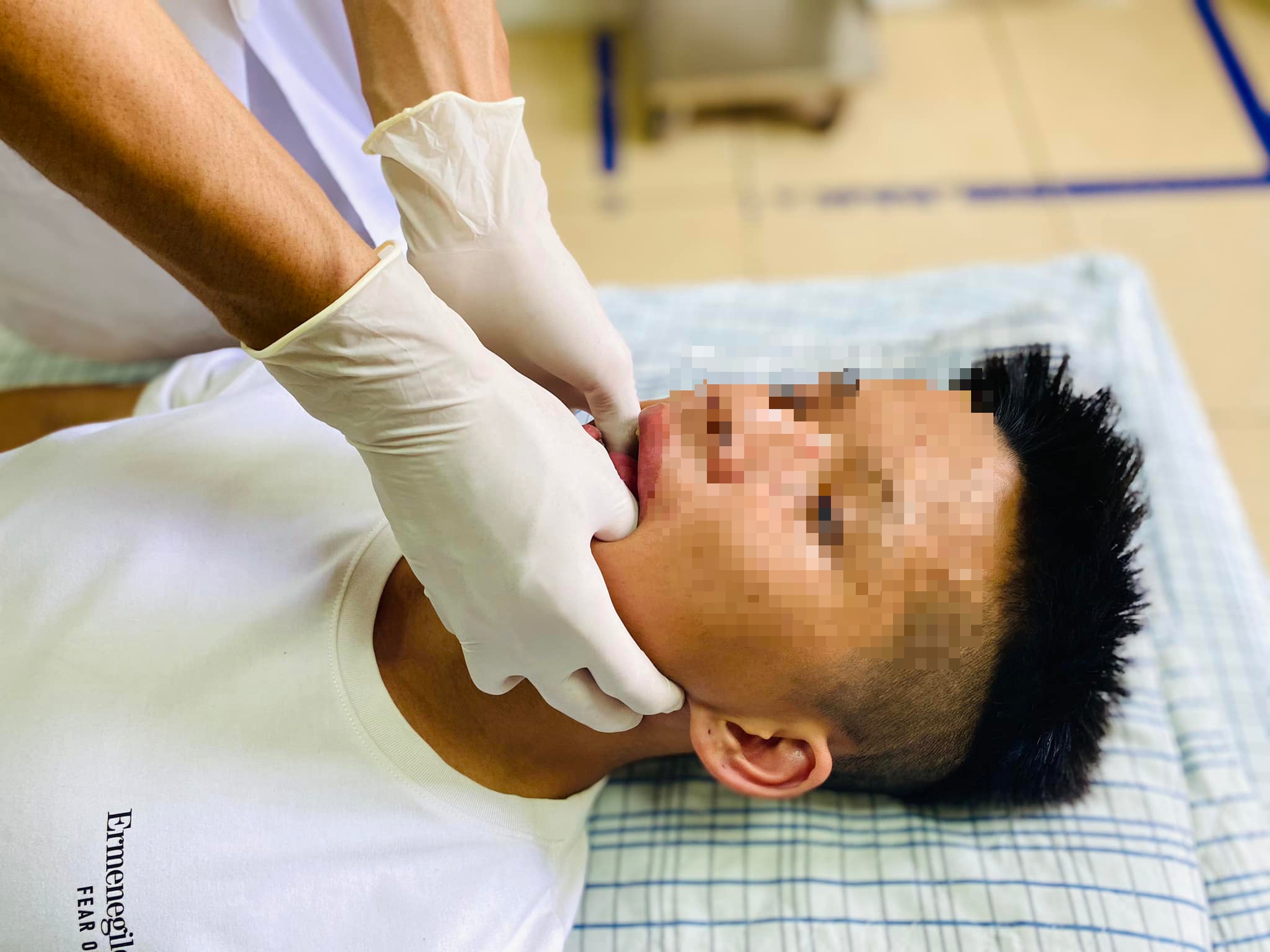 Hy hữu: Nam thanh niên bị trật khớp hàm sau khi ngáp lớn- Ảnh 1. Hy hữu: Nam thanh niên bị trật khớp hàm sau khi ngáp lớn- Ảnh 1.