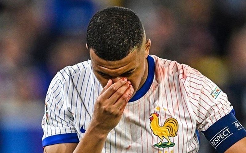 Pháp chơi canh bạc mạo hiểm với Mbappe, CLB Real Madid: Làm ơn, hãy sớm phẫu thuật mũi- Ảnh 1. Pháp chơi canh bạc mạo hiểm với Mbappe, CLB Real Madid: Làm ơn, hãy sớm phẫu thuật mũi- Ảnh 1.