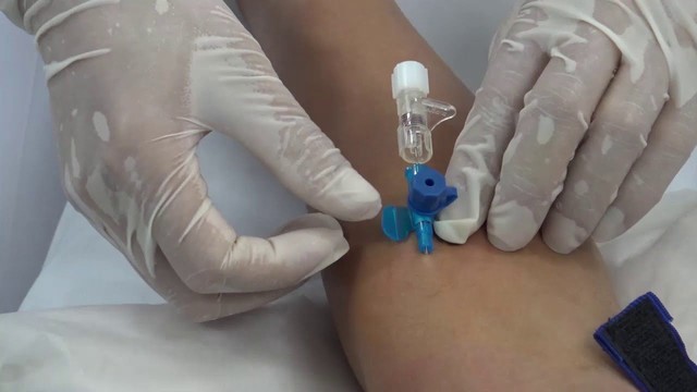 Thanh niên 22 tuổi bị suy thận thừa nhận thường xuyên ăn món ăn mà nhiều bạn trẻ Việt ưa thích- Ảnh 2. Thanh niên 22 tuổi bị suy thận thừa nhận thường xuyên ăn món ăn mà nhiều bạn trẻ Việt ưa thích- Ảnh 2.