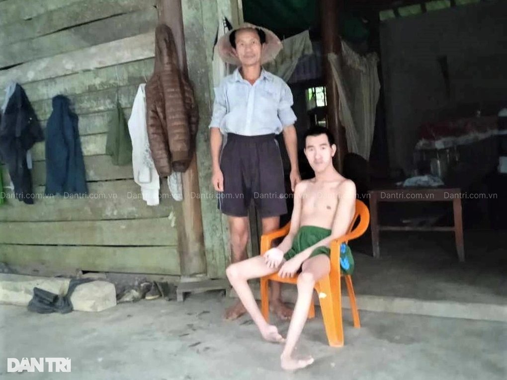 Hơn 255 triệu đồng đến với cô gái trẻ có bố tâm thần, em bại não - 3 Hơn 255 triệu đồng đến với cô gái trẻ có bố tâm thần, em bại não - 3