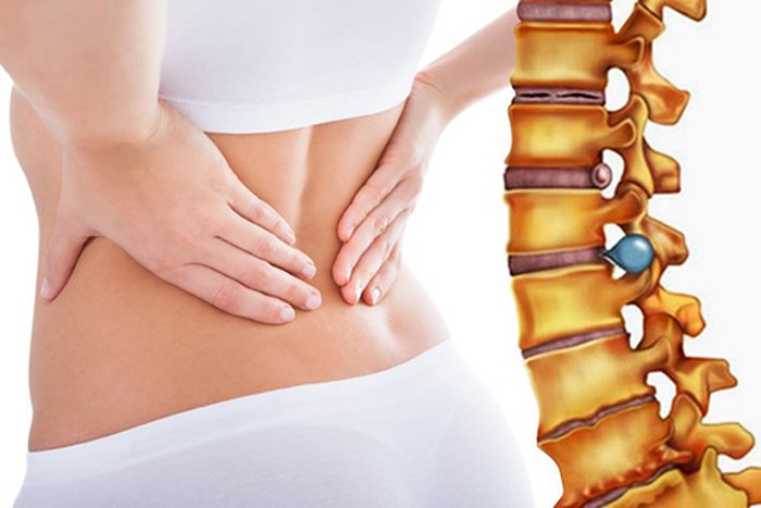 Ngoài việc uống thuốc điều trị thì tham gia hoạt động thể thao có thể giúp giảm đi những cơn đau dai dẳng do thoát vị đĩa đệm gây ra. Ngoài việc uống thuốc điều trị thì tham gia hoạt động thể thao có thể giúp giảm đi những cơn đau dai dẳng do thoát vị đĩa đệm gây ra.