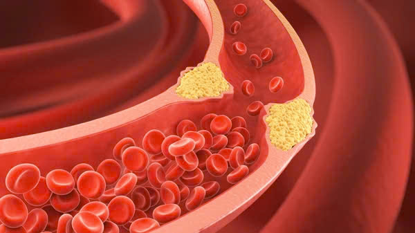 Tác dụng bất ngờ của chuối luộc đối với huyết áp và cholesterol- Ảnh 2. Tác dụng bất ngờ của chuối luộc đối với huyết áp và cholesterol- Ảnh 2.