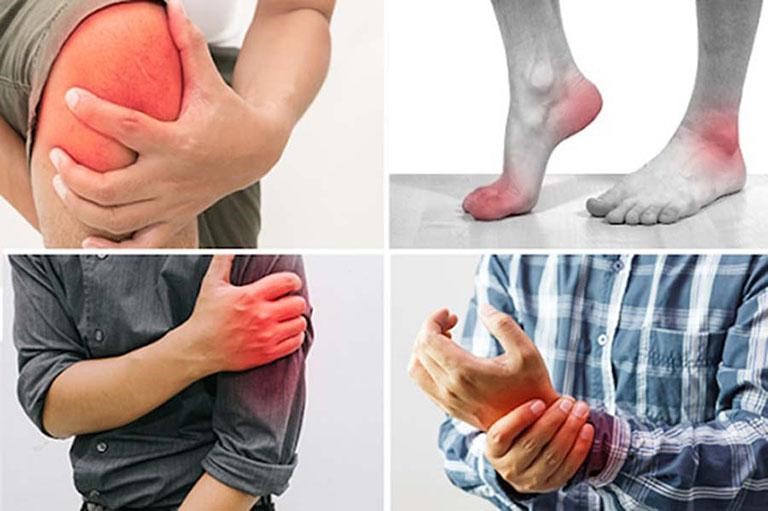 Đau xương khớp khi giao mùa, làm thế nào để giảm bớt triệu chứng?- Ảnh 1. Đau xương khớp khi giao mùa, làm thế nào để giảm bớt triệu chứng?- Ảnh 1.