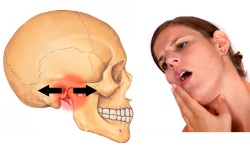Nguyên nhân gây viêm khớp thái dương hàm- Ảnh 1. Nguyên nhân gây viêm khớp thái dương hàm- Ảnh 1.