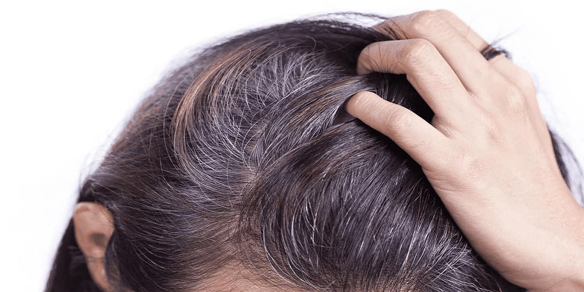 Thực phẩm khắc phục tóc bạc sớm- Ảnh 1. Thực phẩm khắc phục tóc bạc sớm- Ảnh 1.