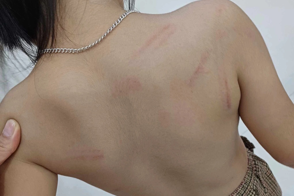 Vụ nhiều trẻ mầm non bị đánh: Rút lại việc tạm đình chỉ công tác cô giáo - 1 Vụ nhiều trẻ mầm non bị đánh: Rút lại việc tạm đình chỉ công tác cô giáo - 1