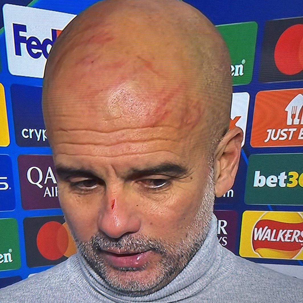 Man City không thắng dù dẫn trước 3 bàn, HLV Guardiola tự 'hành hạ' bản thân- Ảnh 3. Man City không thắng dù dẫn trước 3 bàn, HLV Guardiola tự 'hành hạ' bản thân- Ảnh 3.