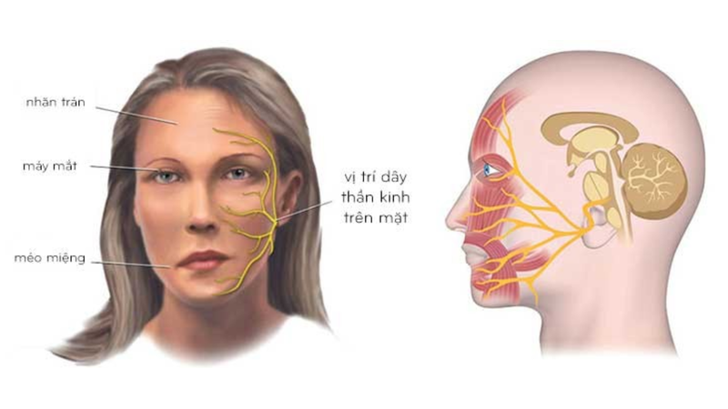 Thời tiết chuyển lạnh, coi chừng liệt dây thần kinh số 7 - Ảnh 1. Thời tiết chuyển lạnh, coi chừng liệt dây thần kinh số 7 - Ảnh 1.