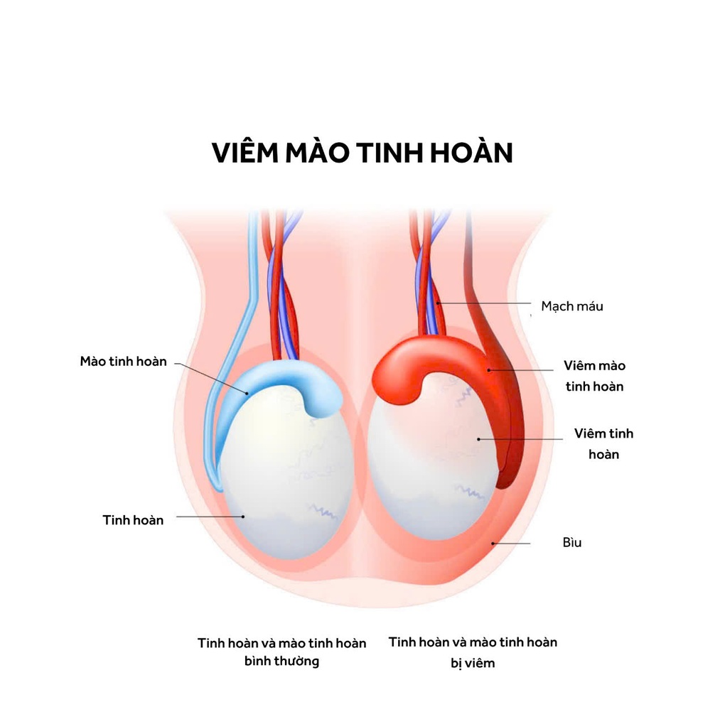 Từ nỗi lo vô sinh sau biến chứng quai bị đến hành trình làm cha đầy bất ngờ - 2 Từ nỗi lo vô sinh sau biến chứng quai bị đến hành trình làm cha đầy bất ngờ - 2