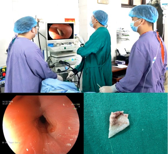 Bé gái 7 tuổi ở Tuyên Quang nhập viện gấp sau khi ăn cháo sáng - Ảnh 2. Bé gái 7 tuổi ở Tuyên Quang nhập viện gấp sau khi ăn cháo sáng - Ảnh 2.