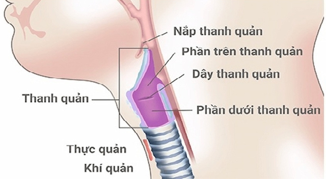 Diễn viên Hồng Ánh gặp vấn đề nghiêm trọng về sức khỏe, căn bệnh của cô nguy hiểm thế nào? - Ảnh 3. Diễn viên Hồng Ánh gặp vấn đề nghiêm trọng về sức khỏe, căn bệnh của cô nguy hiểm thế nào? - Ảnh 3.