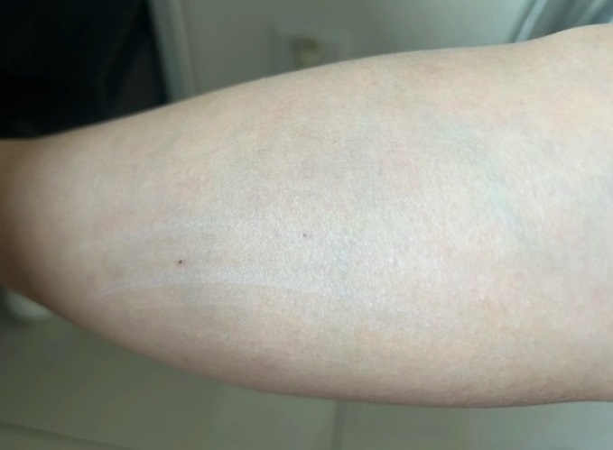 Ngứa da vào ban đêm có nguy hiểm không?- Ảnh 1. Ngứa da vào ban đêm có nguy hiểm không?- Ảnh 1.